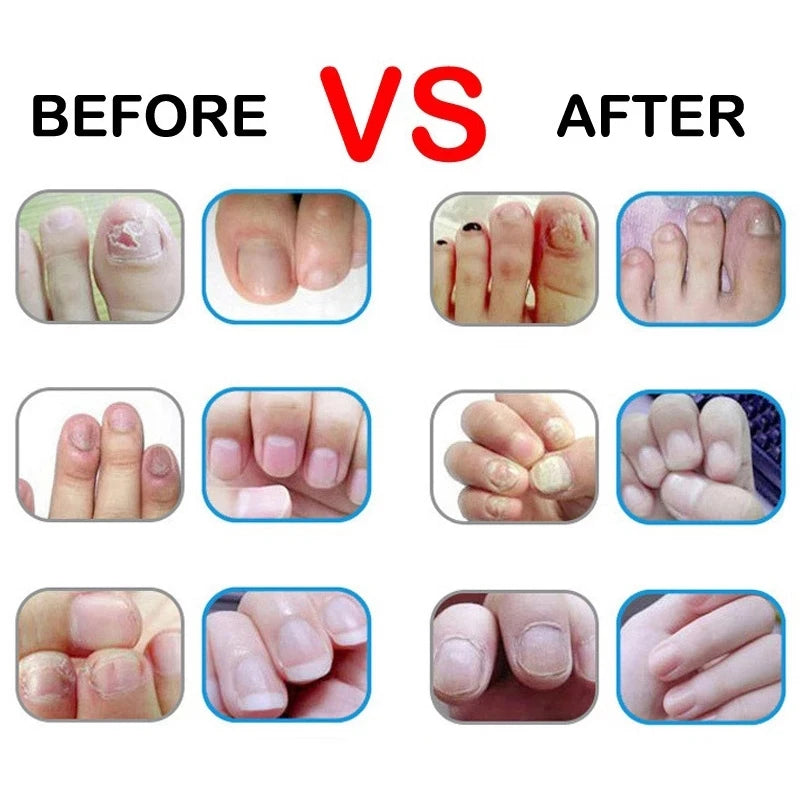 Aceite nutritivo para uñas con 15 aromas, lápiz para tratamiento de uñas, aceite revitalizador de cutículas, previene el envejecimiento de las uñas, esmalte de uñas, nutre la piel, tratamiento de uñas