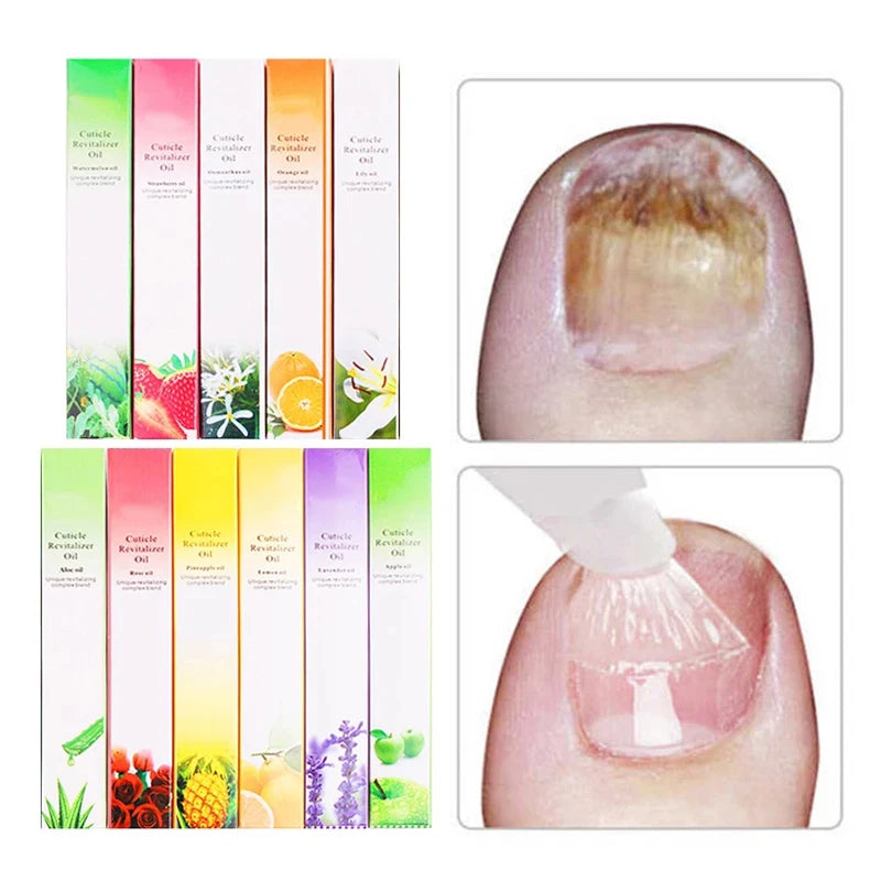 Aceite nutritivo para uñas con 15 aromas, lápiz para tratamiento de uñas, aceite revitalizador de cutículas, previene el envejecimiento de las uñas, esmalte de uñas, nutre la piel, tratamiento de uñas