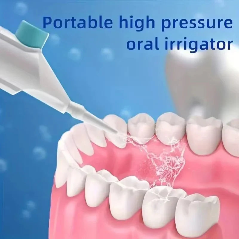 Irrigador bucal de alta presión para el hogar, portátil, con agua limpia, hilo dental, palillo de dientes manual de alta presión (2024)