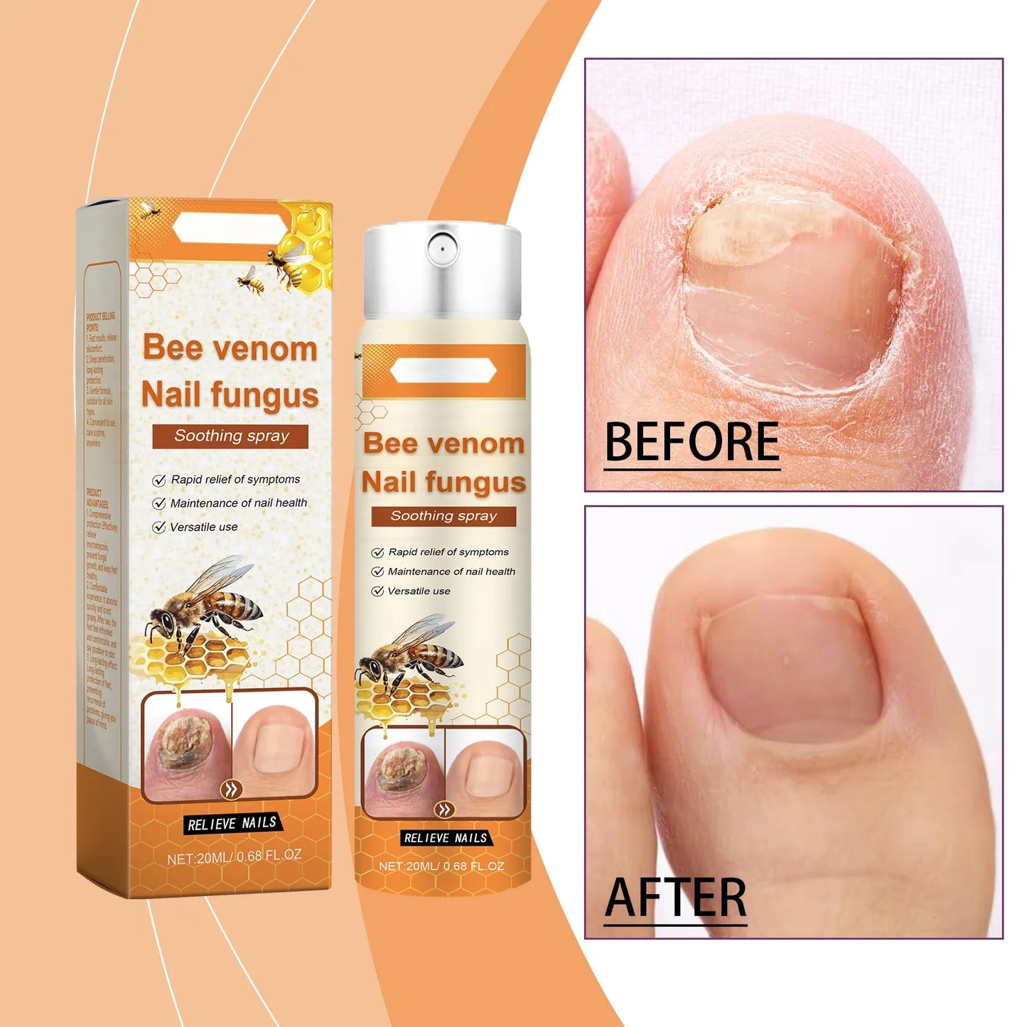 Spray para el cuidado de las uñas, limpiador e hidratante para pies, 20 ml