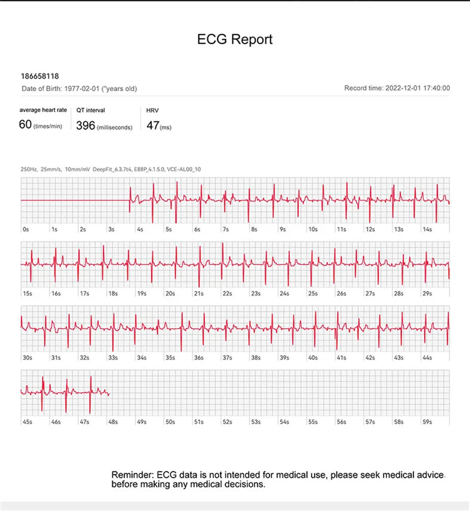 Reloj inteligente con tratamiento láser para hombres, dispositivo con ECG, PPG, frecuencia cardíaca, azúcar en sangre, monitor de salud, para Android e iOS, 2024