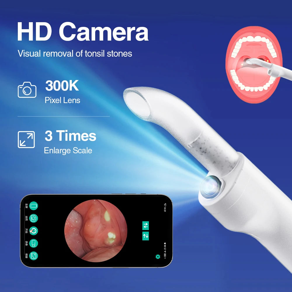 Herramienta eléctrica visible para eliminar cálculos amigdalinos. Kit visible para eliminar cálculos amigdalinos con 3 modos de succión. Cuidado bucal.