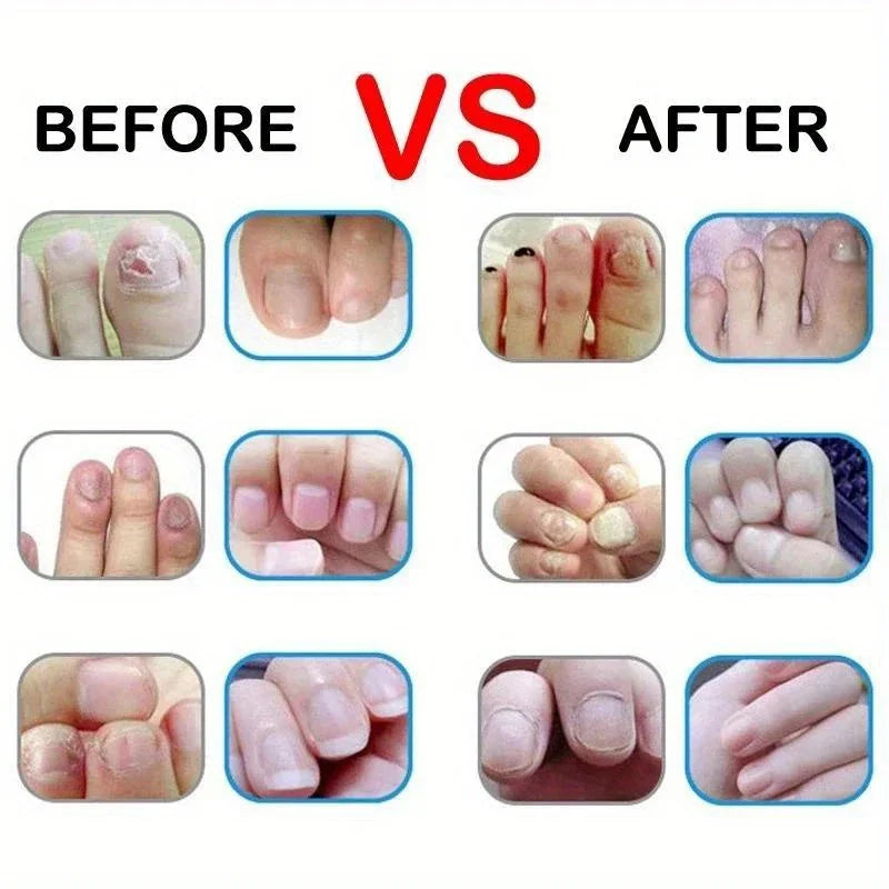 Aceite nutritivo para uñas, lápiz para tratamiento de uñas, aceite revitalizador de cutículas, previene el envejecimiento de las uñas, esmalte de uñas, nutre la piel.