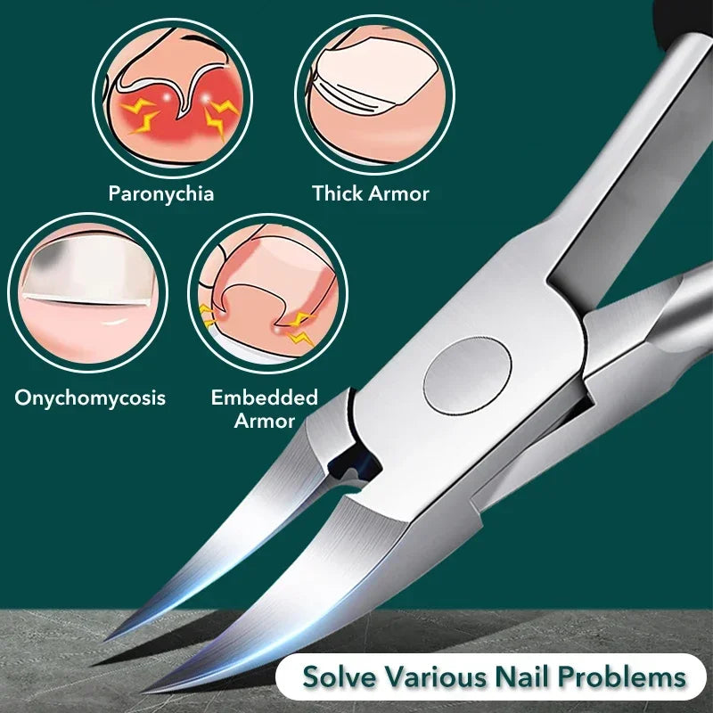 Cortauñas para uñas encarnadas, podología, corrección de cutículas, cortauñas, paroniquia, pedicura, manicura, cuidado de manos y pies.