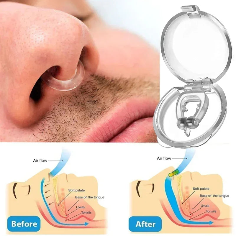 Dispositivo antirronquidos, pinzas nasales de silicona, bandeja magnética para dormir, ayuda para dormir, mejora la respiración, protección contra la apnea, dispositivos nocturnos