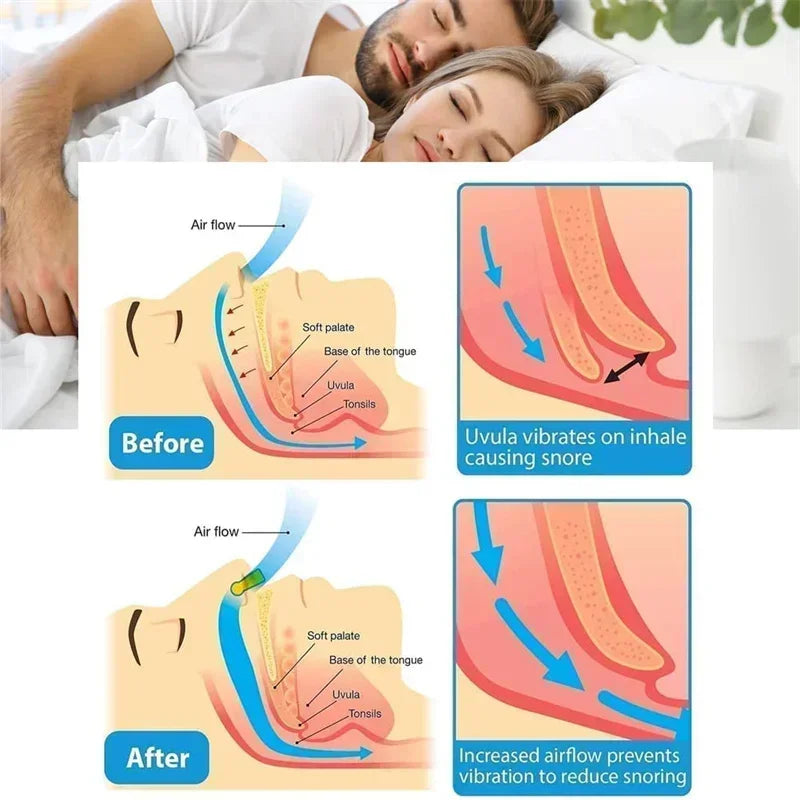 Dispositivo antirronquidos, pinzas nasales de silicona, bandeja magnética para dormir, ayuda para dormir, mejora la respiración, protección contra la apnea, dispositivos nocturnos