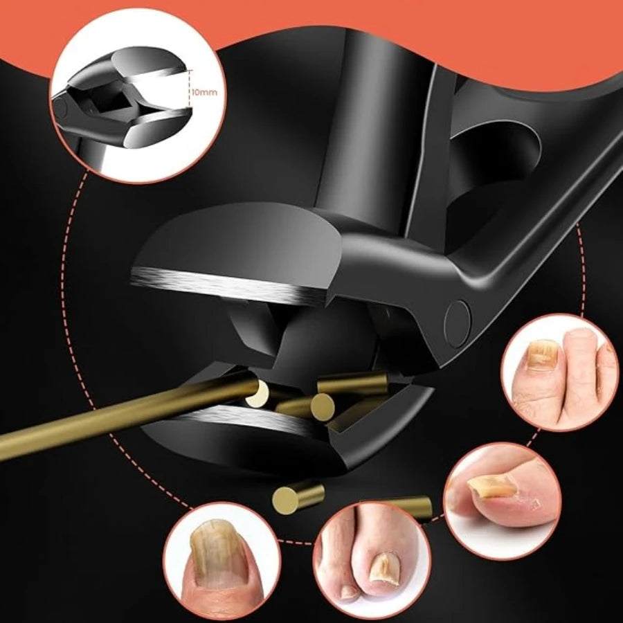 Cortauñas para uñas encarnadas, podología, corrección de cutículas, cortauñas, paroniquia, pedicura, manicura, cuidado de manos y pies.