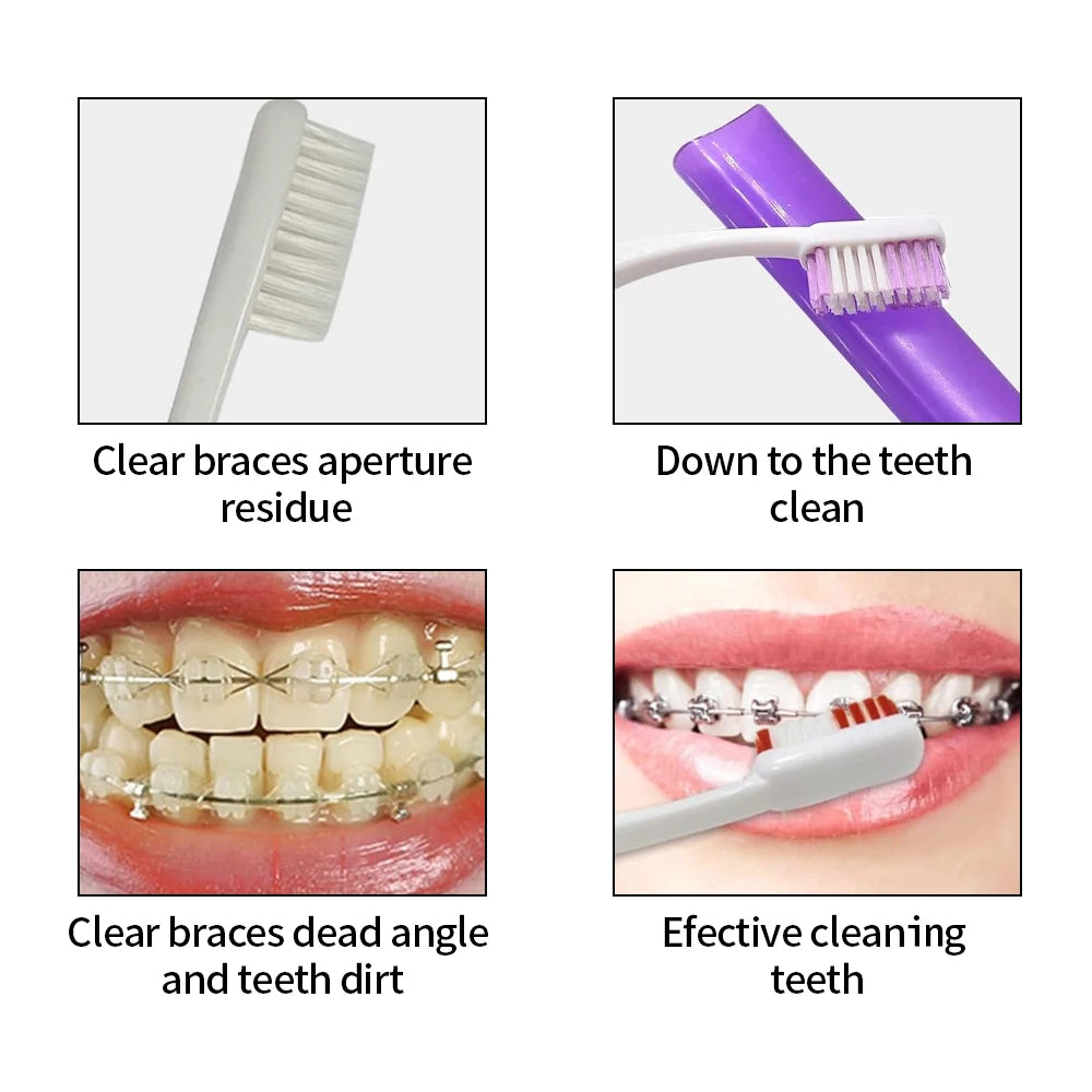 Kit de 8 cepillos de dientes para ortodoncia, incluye cepillo interdental, hilo dental, cera y kit de viaje.