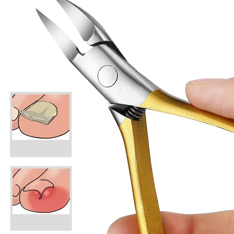 Cortaúñas Tijeras para uñas encarnadas Alicates de corrección podológica Cortacutículas Cortar paroniquia Pedicura Herramienta para el cuidado de los pies