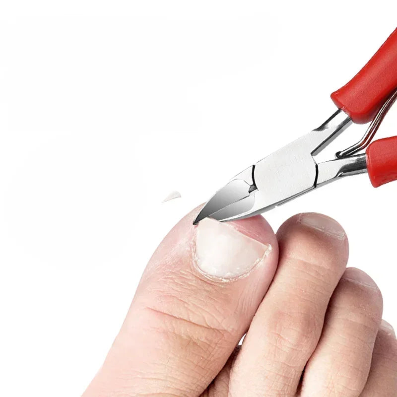 Cortauñas para uñas encarnadas, podología, corrección de cutículas, cortauñas, paroniquia, pedicura, manicura, cuidado de manos y pies.