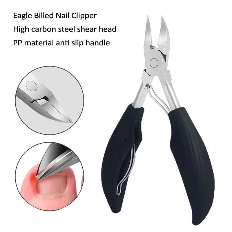 Cortauñas para uñas encarnadas, podología, corrección de cutículas, cortauñas, paroniquia, pedicura, manicura, cuidado de manos y pies.