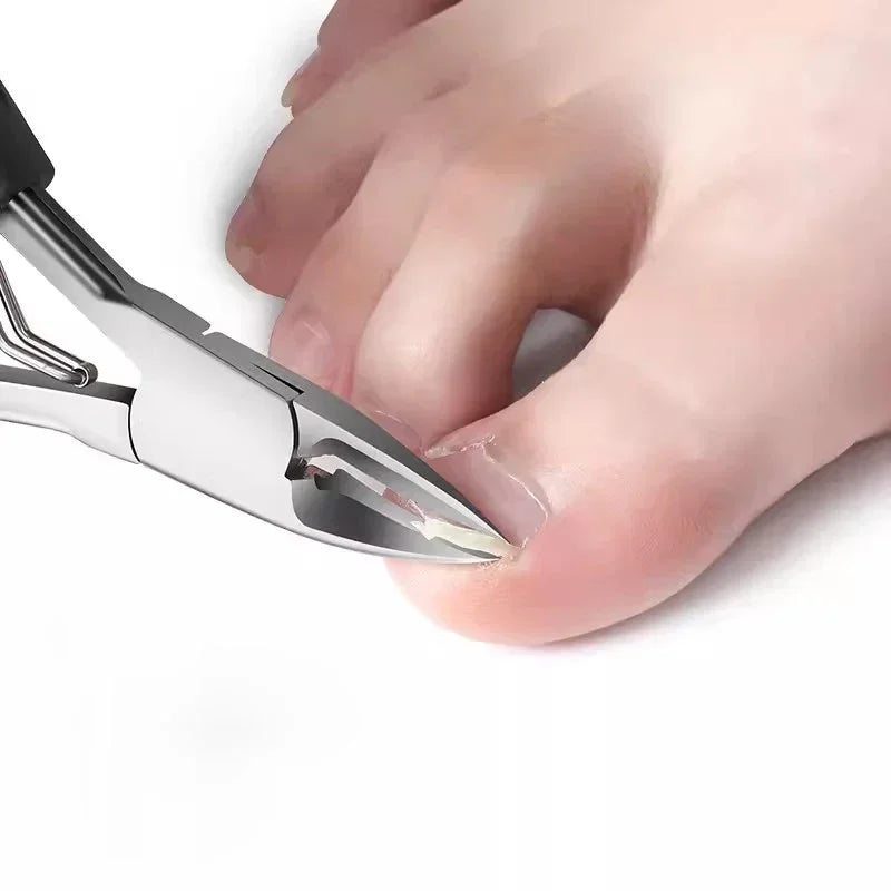 Cortauñas para uñas encarnadas, podología, corrección de cutículas, cortauñas, paroniquia, pedicura, manicura, cuidado de manos y pies.