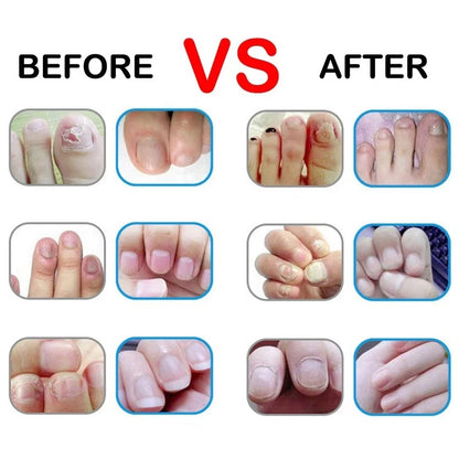 Aceite nutritivo para uñas con 15 aromas, lápiz para tratamiento de uñas, aceite revitalizador de cutículas, previene el envejecimiento de las uñas, esmalte de uñas, nutre la piel, tratamiento de uñas
