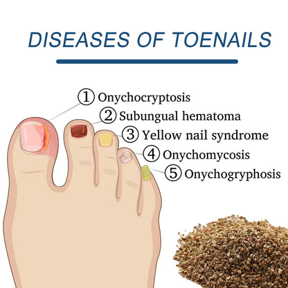 Parche de tratamiento reparador de uñas, mejora el engrosamiento de las uñas grises, infecciones por hongos y uñas encarnadas, corrección de uñas, adhesivo, producto para el cuidado de los pies.
