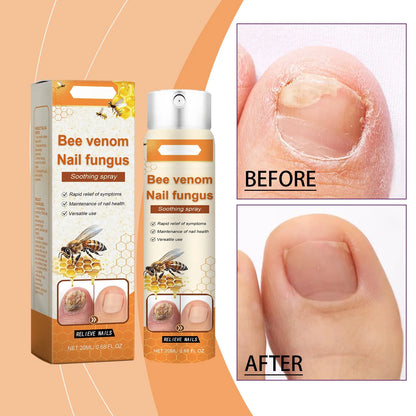 Spray para el cuidado de las uñas, limpiador e hidratante para pies, 20 ml
