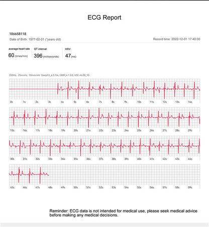 Reloj inteligente con tratamiento láser para hombres, dispositivo con ECG, PPG, frecuencia cardíaca, azúcar en sangre, monitor de salud, para Android e iOS, 2024