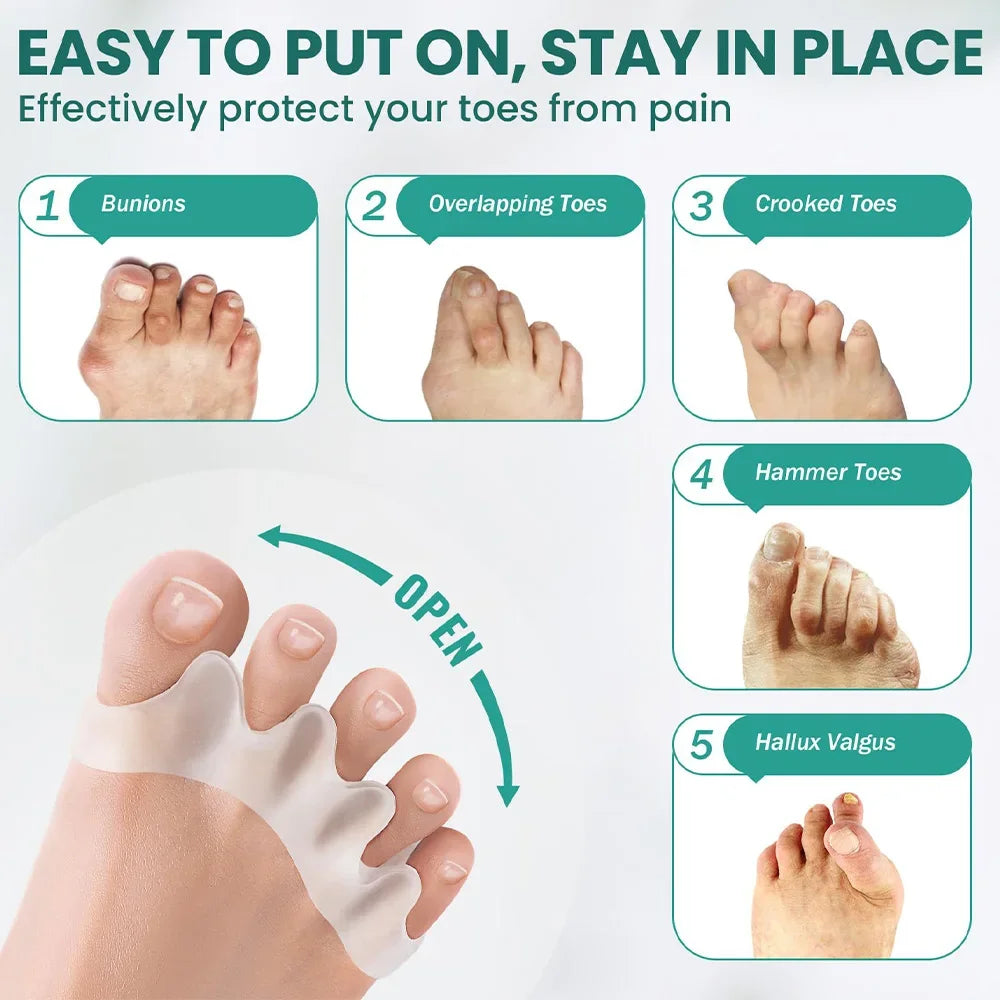Separador de dedos de silicona, corrector de juanetes y dedo en martillo, de silicona suave, para el cuidado de los pies.