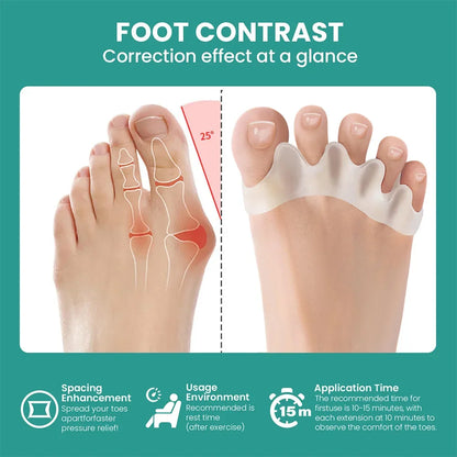 Separador de dedos de silicona, corrector de juanetes y dedo en martillo, de silicona suave, para el cuidado de los pies.