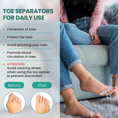 Separador de dedos de silicona, corrector de juanetes y dedo en martillo, de silicona suave, para el cuidado de los pies.