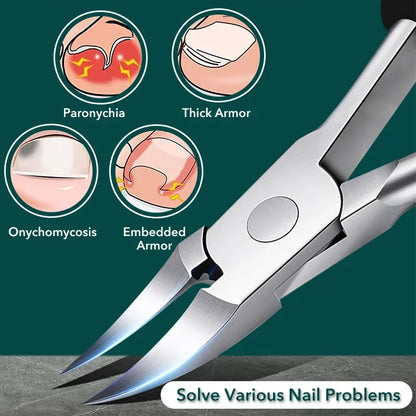 Cortauñas para uñas encarnadas, podología, corrección de cutículas, cortauñas, paroniquia, pedicura, manicura, cuidado de manos y pies.
