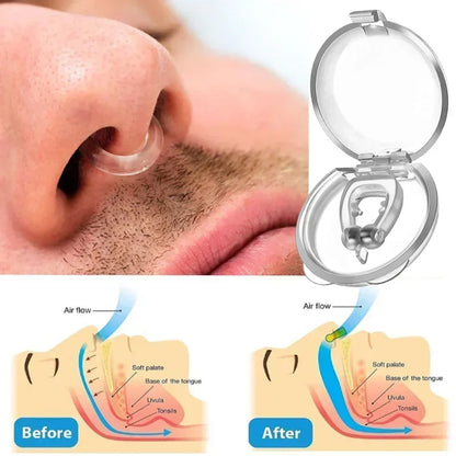 Dispositivo antirronquidos, pinzas nasales de silicona, bandeja magnética para dormir, ayuda para dormir, mejora la respiración, protección contra la apnea, dispositivos nocturnos