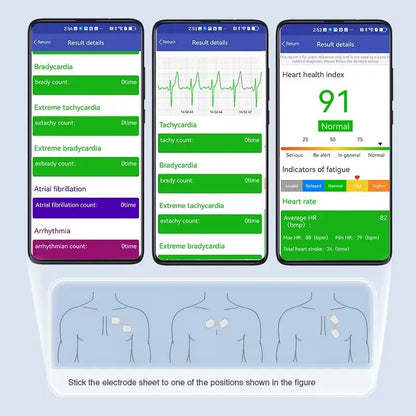 Consumibles médicos BOXYM Electrodos de ECG inalámbricos desechables Electrodo de ECG para adultos Parche adhesivo para electrocardiograma