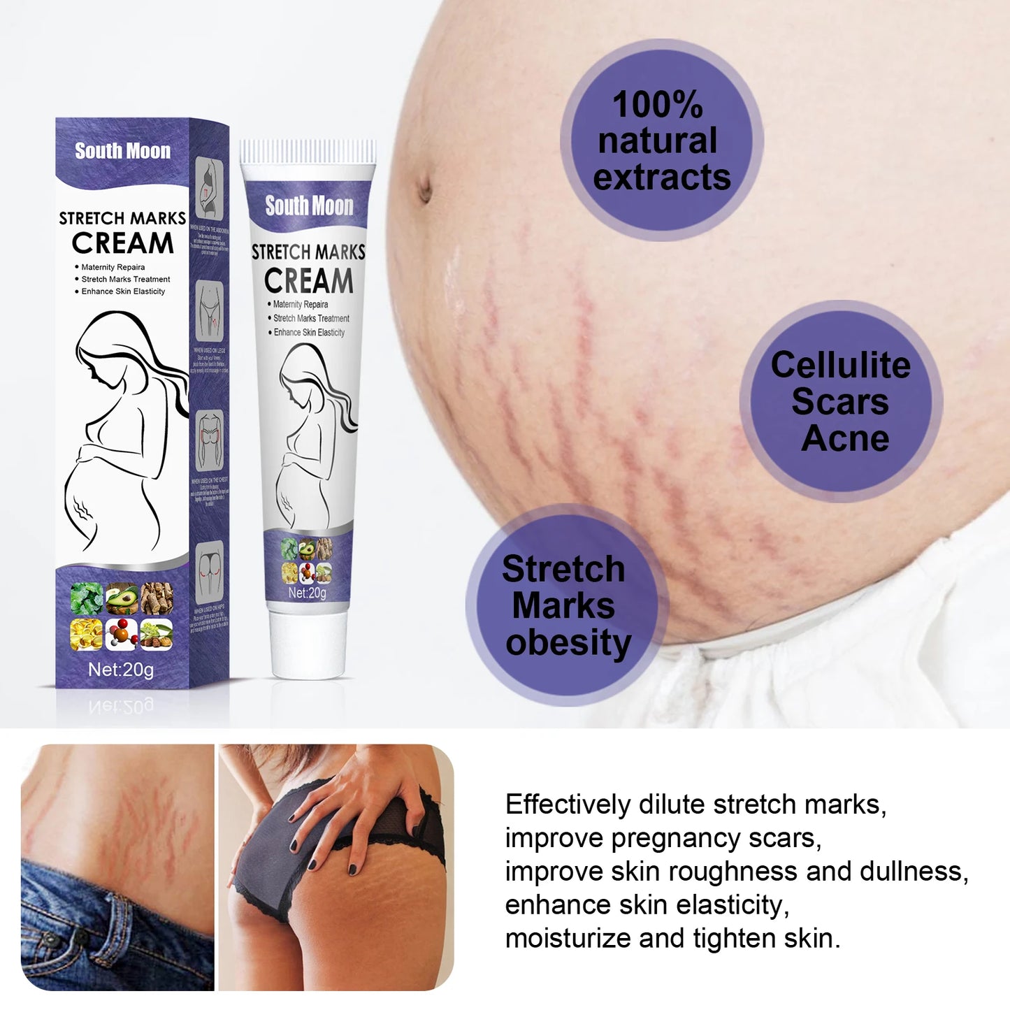 Crema para eliminar las estrías del embarazo, mejora la elasticidad, atenúa las líneas de crecimiento, suaviza, nutre, hidrata y reafirma la piel.