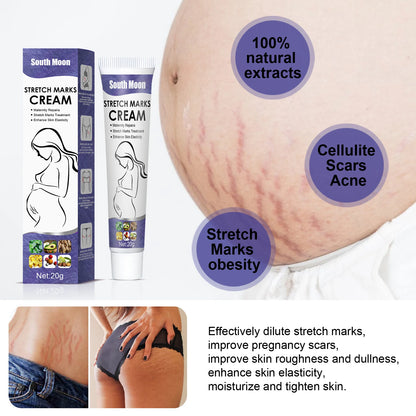 Crema para eliminar las estrías del embarazo, mejora la elasticidad, atenúa las líneas de crecimiento, suaviza, nutre, hidrata y reafirma la piel.